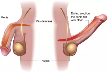 best hospital for penile implant surgery in mohali, ed treatment in mohali, best sexologist in mohali, penis surgery in mohali, surgery for increasing penis length in mohali, Penile Implant Surgery for Errectie Dysfunction in Mohali, Cost of Penile Implant Surgery in Punjab, India