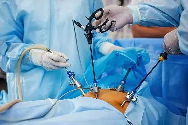 best doctor for laparoscopic hystrectomy in mohali, best doctor for laparoscopic ovarian cyst surgery, best gynae laparoscopic surgeon in mohali